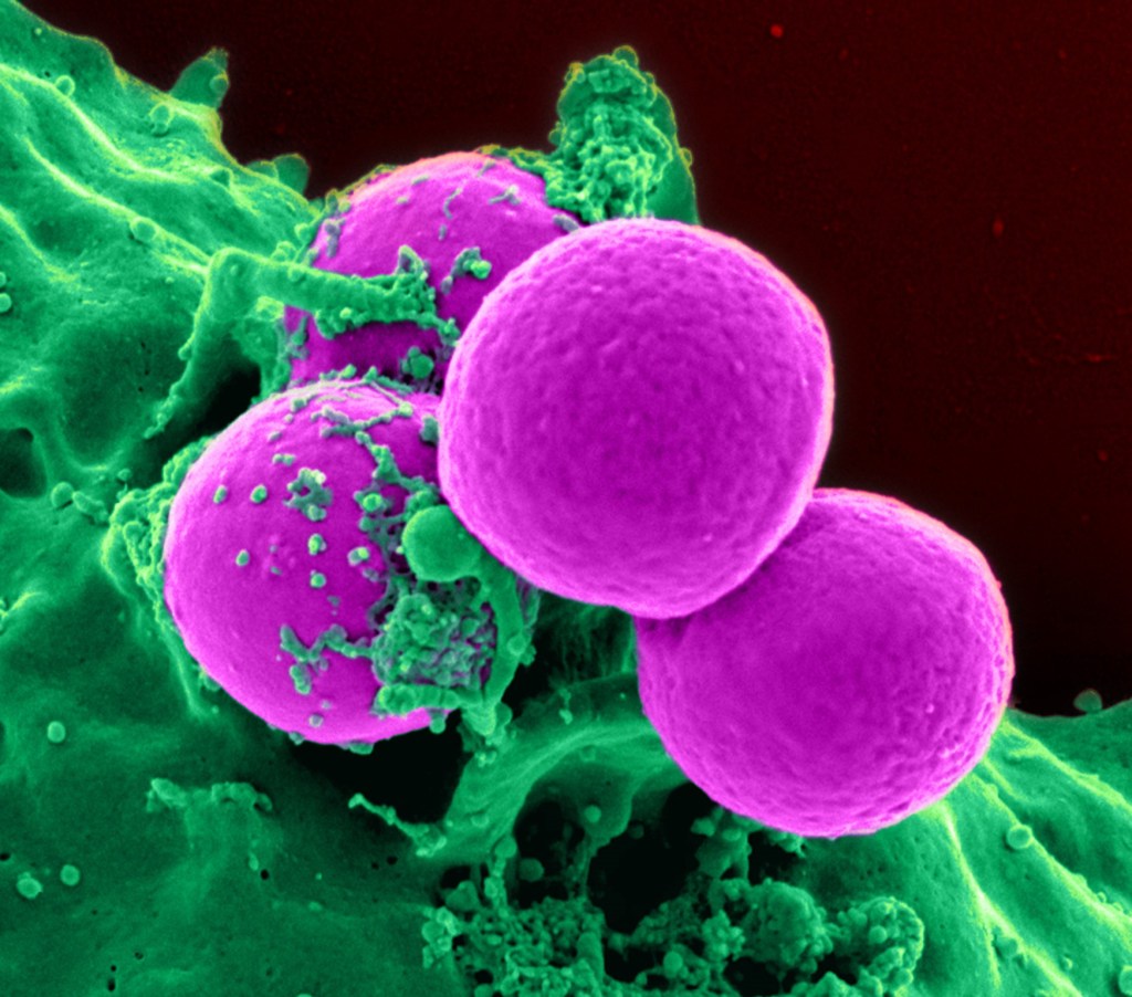 Neutrophil eating MRSA bacteria